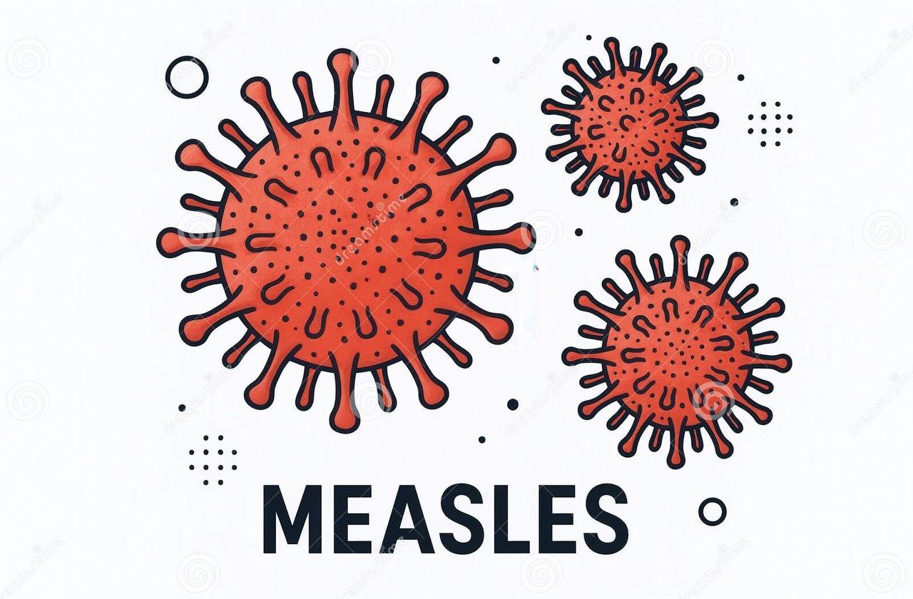 የኩፍኝ በሽታ (Measles)